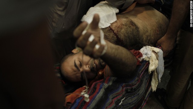 A Morsy supporter lies wounded on a stretcher at the Rabaa al-Adawiya Medical Center on August 14.