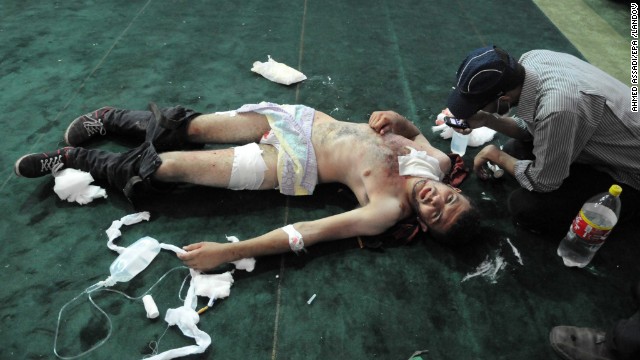 A protester receives treatment at the Al-Fateh mosque in Cairo on August 16.