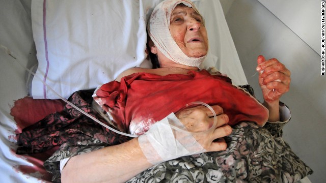 A woman rests after being injured by a blast in Tripoli.