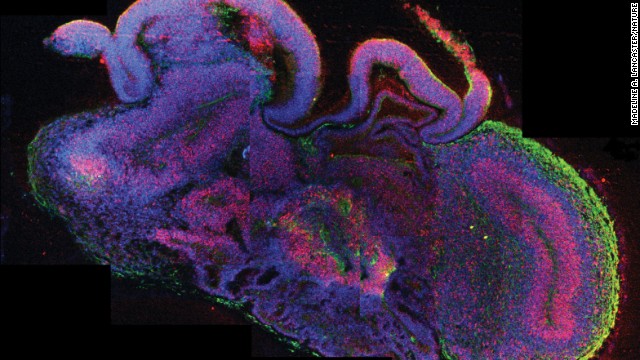 A cross-section of a brain organoid shows neural stem cells in red, and neurons in green.