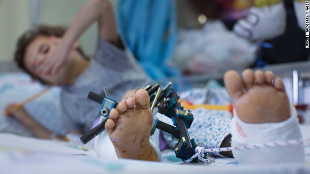 A wounded Syrian child is treated at the Israeli Ziv hospital on Wednesday, August 28, in the northern town of Safed, Israel. About 140 wounded Syrians, who have been fighting across the border from Israel, have been treated in Israeli hospitals since the beginning of the Syrian Civil war.