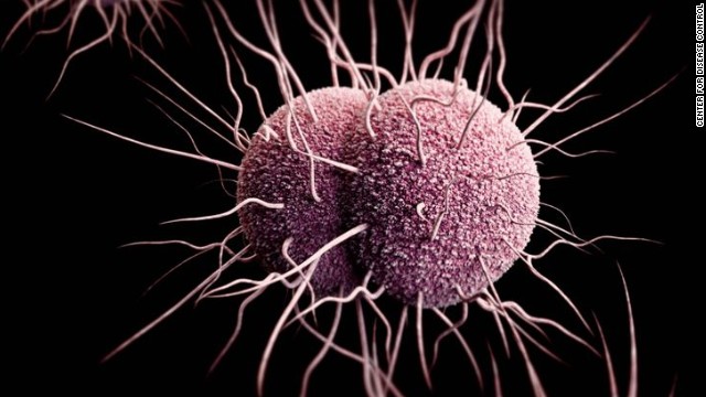 Drug-resistant bacteria gonorrhoeae