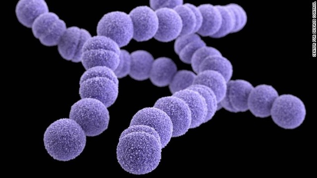 Erythromycin-resistant Group A Streptococcus