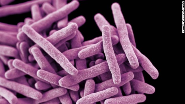 Drug-resistant tuberculosis