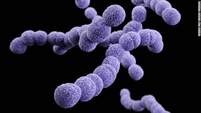 Clindamycin-resistant group B Streptococcus 