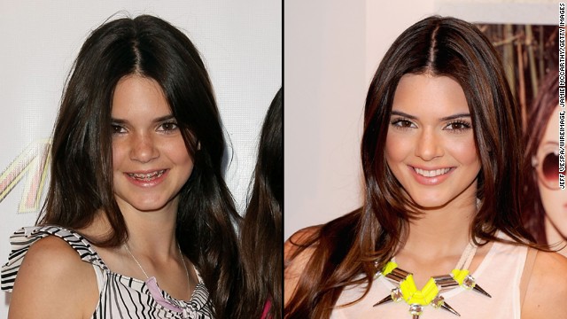 Kendall Jenner, now 17, has grown up before America's eyes on her family's reality TV show, "Keeping Up With the Kardashians." At left, she attended the opening of a retail store at age 11.