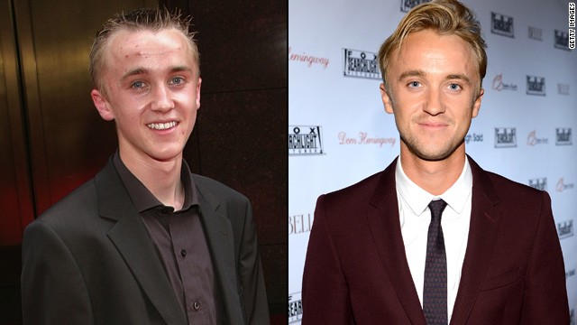 Just enough time has passed for us to stop cringing at the sight of Tom Felton, who came to be known as the weakling bully Draco Malfoy. Even while working on the "Potter" franchise, Felton dabbled in other films, like "The Disappeared" and "Get Him to the Greek." Felton has been busy since "Potter" wrapped, and appeared in the World War II movie "Ghosts of the Pacific" and the TNT cop drama "Murder in the First."