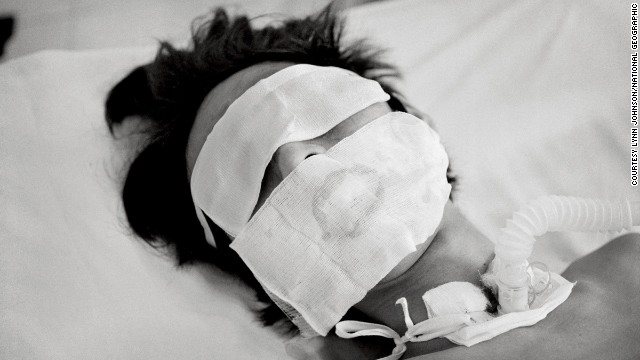 Comatose and on a ventilator, a bird flu patient in Hanoi who was not expected to live made a remarkable recovery, in this haunting photograph by Lynn Johnson.