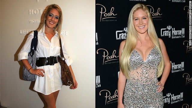 Heidi Montag started with breast augmentation and a nose job in 2007 and eventually<a href='http://www.cnn.com/2010/SHOWBIZ/TV/01/13/heidi.montag.plastic.surgery/'> opted for 10 surgeries</a> in order to change her look -- leaving her unrecognizable to many of her fans from the reality show "The Hills." 