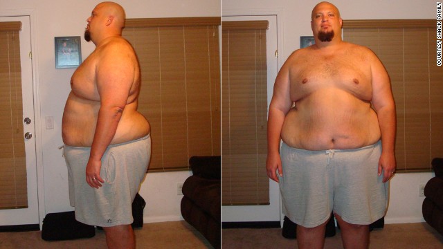 At his heaviest in June 2009, Matthew Shack weighed 500 pounds. He decided he was going to lose weight by tracking his calorie intake every day. 