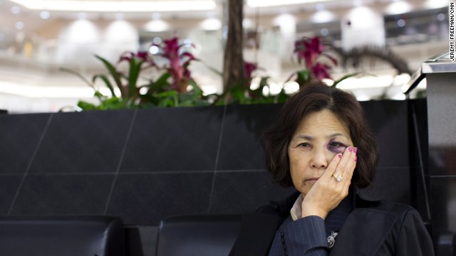 Mi Ja Choi sits in the atrium of the Domestic Terminal. Police say they don't know how she was injured. Repeated attempts to follow up with her or her family have been unsuccessful.