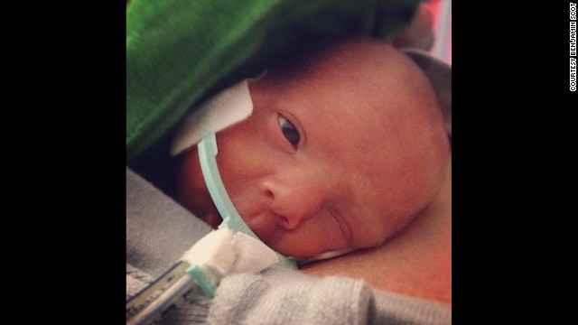 Born 3.5 months early, Ward Miles Miller weighed only 1 pound, 13 ounces. 