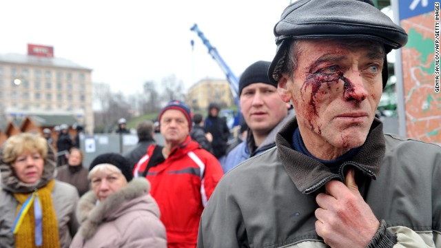 A protester injured in clash with police stands on Independence Square in Kiev, Ukraine, on Saturday, November 30. Protesters gathered in the main square to protest the government's decision not to sign a landmark trade deal with the European Union.