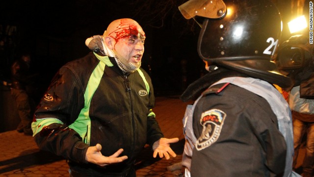 A bleeding protester shouts at a police medic after police pushed protesters off the street leading to the presidential administration building on December 1.