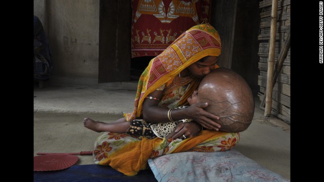 <strong>April 13:</strong> Indian villager Fatima Begum kisses the head of her 18-month-old daughter, Roona, at their hut in Jirania, India. Roona suffers from hydrocephalus, a disorder causing cerebral fluid to build up in the brain. Doctors had given her just a few months to live, but she recently underwent surgery to improve her condition.