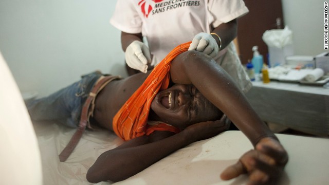 A young man who was hit in the back by a stray bullet cries out in pain at a Medecins sans Frontieres clinic in Bangui on Wednesday, December 25. 