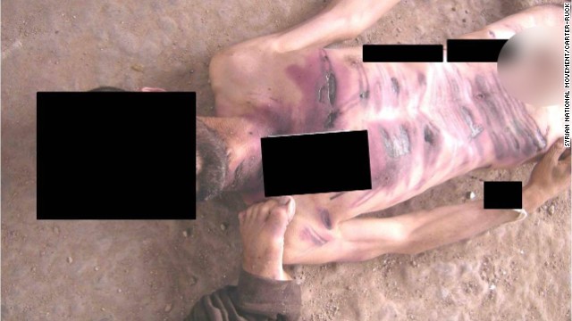 Wounds line the chest and abdomen of a man allegedly killed in Syrian government custody.