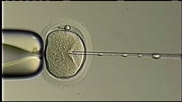 Universidad de Utah investiga un presunto caso de cambio de esperma
