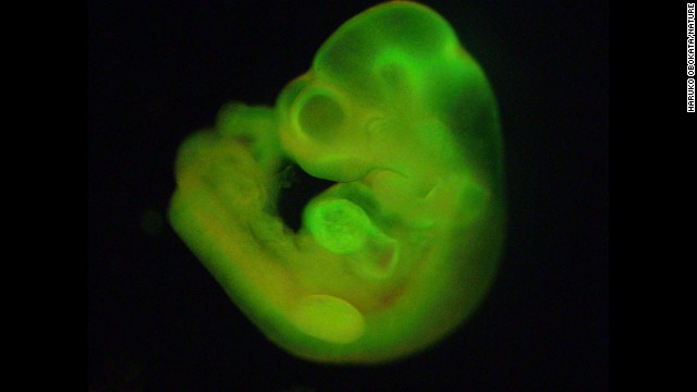 Researchers have developed a new method of making stem cells. Mouse cells were "stressed" in several ways, such as by being placed in an acidic environment. Researchers were then able to use those cells to generate various tissues in developing mice. This image shows a mouse fetus that has tissues that grew, in part, from the stem cells. Click through the gallery to learn more about stem cell research.