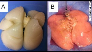 Image A is before new cells were reseeded. The finished product is image B.