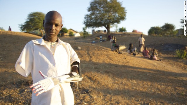 Daniel is a Sudanese boy who lost both arms when a bomb exploded a few meters from him. When American Mick Ebeling heard Daniel's story, he decided to do something to help.