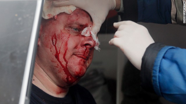 A Ukrainian police officer receives medical care after being attacked at the police station in Horlivka on April 14.