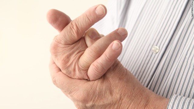 Herbal remedy may improve arthritis symptoms
