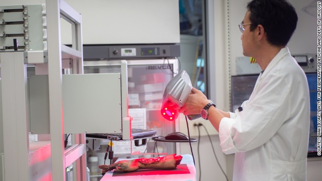 Wake Forest School of medicine in the United States is developing a printer that will print skin straight onto the wounds of burn victims. Pictured, a researcher works on a prosthetic "burned" hand.