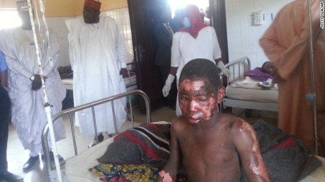 A man receives treatment at Konduga specialist hospital after a gruesome attack on January 26. It was suspected that Boko Haram militants opened fire on a village market and torched homes in the village of Kawuri, killing at least 45 people.