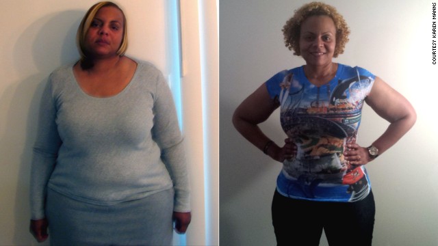 Una mujer pierde 30 kilos y explica por qué la cirugía no es la solución para bajar de peso