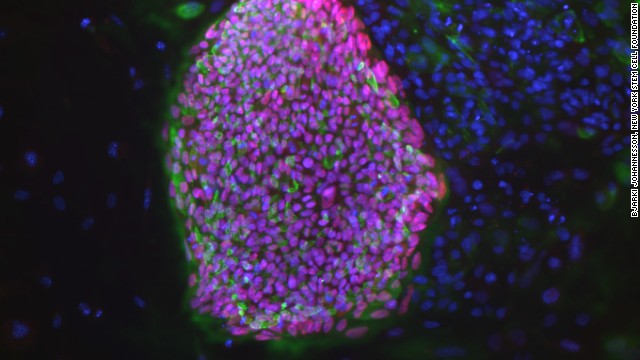 Scientists grow mini brains from stem cells