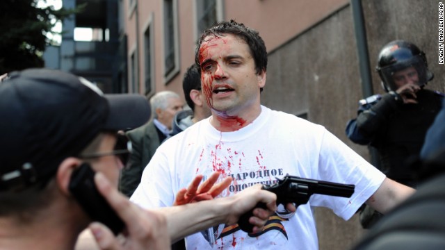 An injured Pro-Russian activist speaks with an armed protester during clashes with police in front of the regional administration building in Donetsk on May 1.