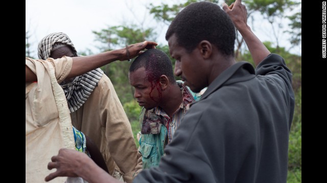 An injured man is tended to after the attack.