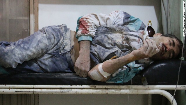 An injured man lies in a hospital bed after alleged airstrikes by government forces in Aleppo on Sunday, May 18.