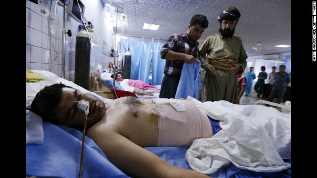 A Kurdish Peshmerga fighter injured in clashes with ISIS lies in a hospital in Irbil on June 18.