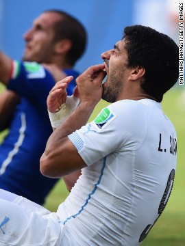 Suarez has previous on the biting front, having been banned for similar incidents in Holland and in England.