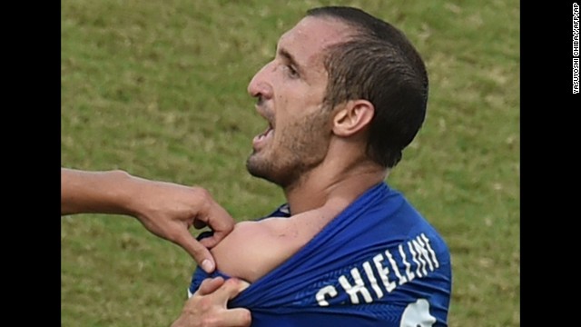 Chiellini shows an apparent bite mark on his shoulder. "Suarez is a sneak, and he gets away with it because FIFA want their stars to play in the World Cup," Chiellini told Sky Sports Italia.