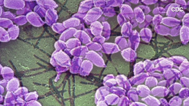 Cdc Lab Director Resigns After Anthrax Incident 8938