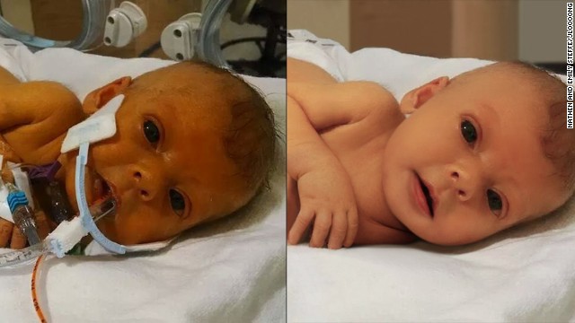 Una pareja pide en redes ayuda para retocar una foto de su bebé fallecida