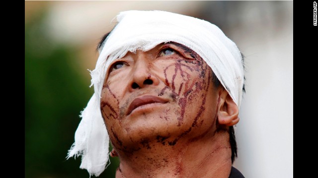 A man with dried blood stains on his face stands on a street in Longtoushan on August 4.