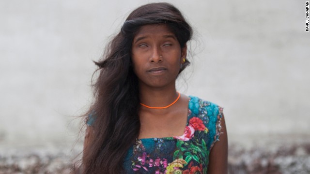 Chanchal, along with her sister Sonam, were attacked after they protested when a group of boys were teasing them.