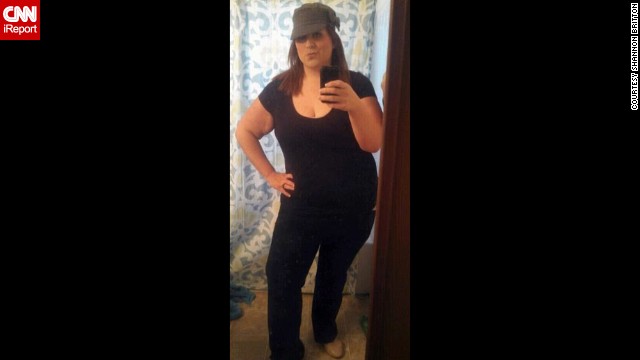 One year after her surgery, Britton was down to 300 pounds. 
