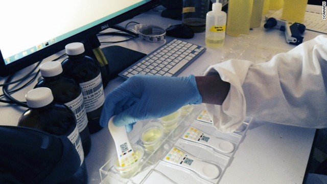A Scandu employee tests Scanaflo urine tests. The results are imported into a smartphone app by taking a photo of the paddle. 