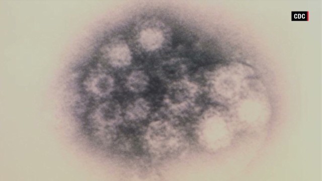 Las infecciones causadas por enterovirus son difíciles de rastrear