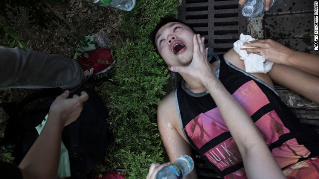 An injured protester is tended to after clashing with riot police outside Hong Kong government complex on Saturday, September 27. 