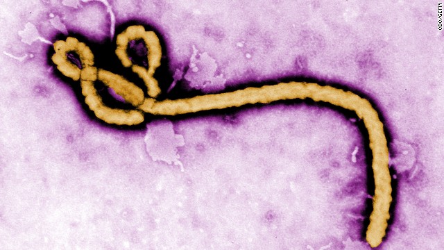 Escocia confirma su primer caso de ébola