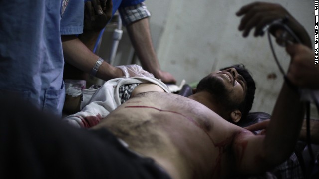 A Syrian rebel fighter lies on a stretcher at a makeshift hospital in Douma, Syria, on Wednesday, July 9. He was reportedly injured while fighting ISIS militants.