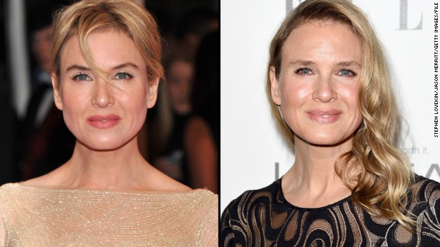 When Renee Zellweger arrived at the 2014 Elle Women in Hollywood awards October 20, <a href='http://www.dailymail.co.uk/tvshowbiz/article-2801157/renee-zellweger-looks-drastically-different-elle-event.html' >some people said they couldn't</a> recognize her. Perhaps that's because the "Bridget Jones" star has spent less time in the public eye recently; her last film credit was in 2010. That should change soon, however: Zellweger's next film, "The Whole Truth," is due in 2015. 