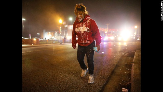 A woman treats her face for possible tear gas exposure on November 24.