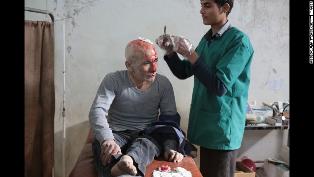 A wounded man is treated at a makeshift hospital in Damascus, Syria, following a reported air strike by government forces on Tuesday, November 11.